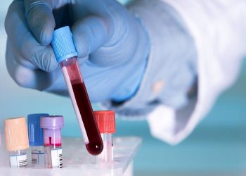 ¿Y si el Parkinson se pudiese diagnosticar con un análisis de sangre?