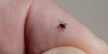 Picaduras de garrapatas: qué debes hacer para prevenirlas y curarlas
