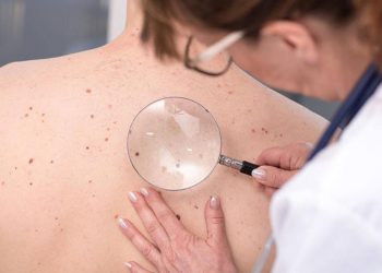 ¿Sabías que el cáncer de piel es mucho más que el melanoma o el carcinoma?
