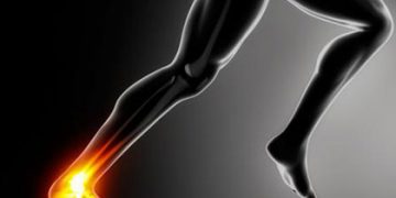Tendinitis de Aquiles: los ejercicios que te ayudarán a reducir el dolor