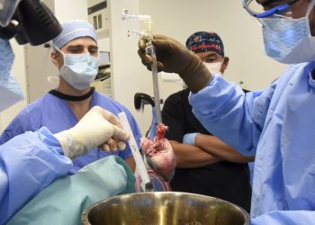Realizan el segundo trasplante de un corazón de cerdo a un humano para intentar salvarlo