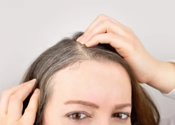 ¿Qué alimentos pueden retrasar la aparición de canas?
