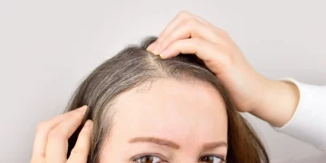 ¿Qué alimentos pueden retrasar la aparición de canas?