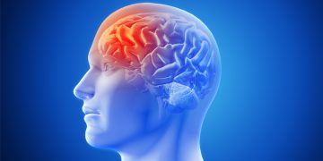 Migraña: consumo de opiáceos y otros errores que debes evitar