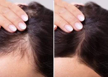 Trucos para saber usar la cebolla roja en el cuidado el pelo