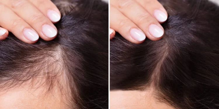 Trucos para saber usar la cebolla roja en el cuidado el pelo