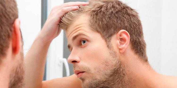 Los otros trasplantes de pelo: barba, cejas…