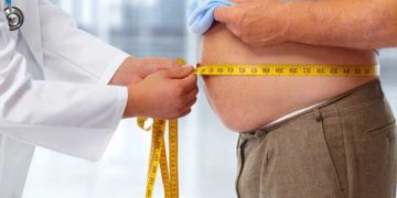 Mapa de la obesidad: más del 50% de los adultos tiene exceso de peso