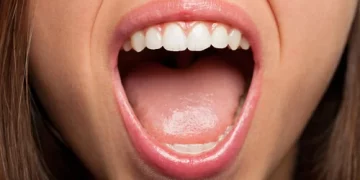 6 señales que indican que se te caerá un diente
