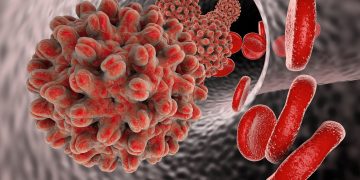 Hepatitis B
