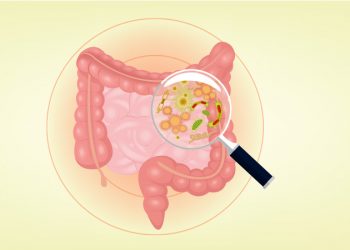 Cómo detectar el cáncer de colon