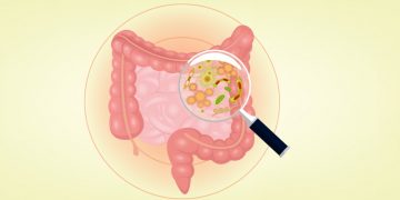 Cómo detectar el cáncer de colon
