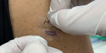 Fentanilo: para qué sirve y efectos adversos de este analgésico opioide