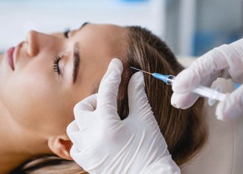 Innovación en terapia capilar: bótox contra la calvicie
