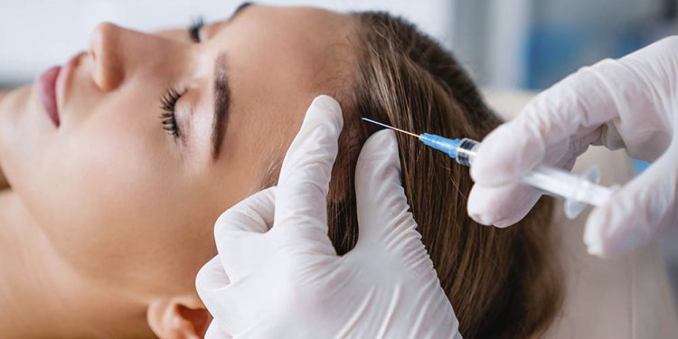 Innovación en terapia capilar: bótox contra la calvicie