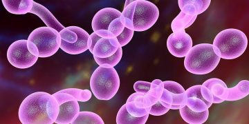 Candidiasis: cómo hacerle frente mediante la dieta