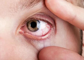 Si tienes los ojos secos, puede ser por lo que comes