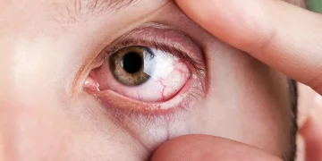 Si tienes los ojos secos, puede ser por lo que comes