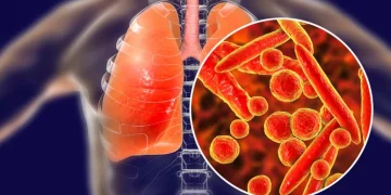 Los mejores alimentos frente a la neumonía, gripe, covid y otras infecciones respiratorias