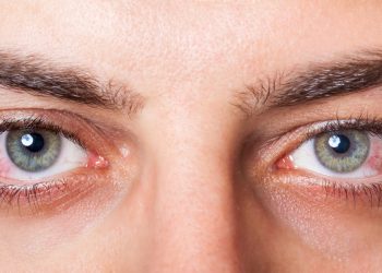 Si tienes los ojos secos, puede ser por lo que comes