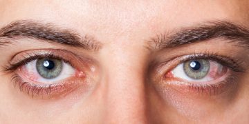Si tienes los ojos secos, puede ser por lo que comes