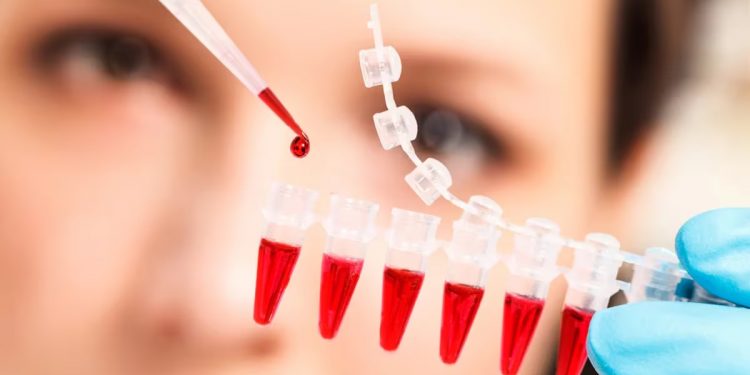 Cómo funciona el nuevo análisis de sangre que detecta 18 tipos de cáncer en etapas tempranas