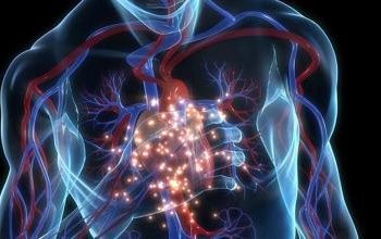 ¿Por qué los infartos en medio del tráfico se han vuelto un fenómeno constante?