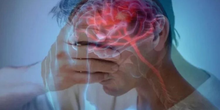 Advierte sobre factores de riesgo pueden provocar un aneurisma cerebral