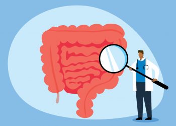 Descubre bacterias únicas relacionadas con tumores asociados con el cáncer colorrectal