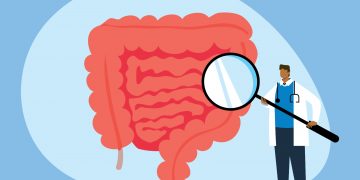 Descubre bacterias únicas relacionadas con tumores asociados con el cáncer colorrectal