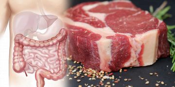 Especialista cita la carne roja como factor de riesgo para el cáncer colorrectal