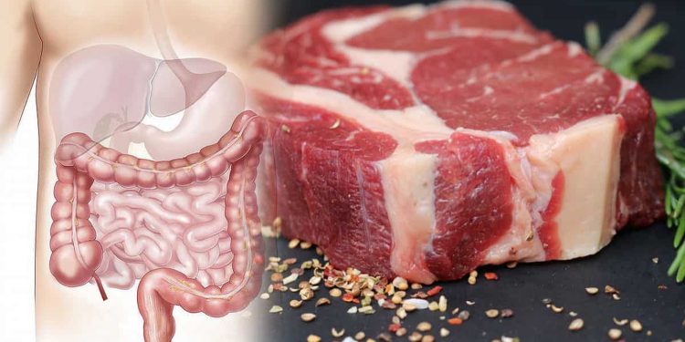 Especialista cita la carne roja como factor de riesgo para el cáncer colorrectal