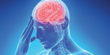 Ictus en jóvenes: ojo con los factores de riesgo atípicos