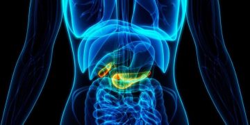 Estos son los factores de riesgo del cáncer de páncreas, según Harvard
