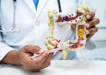 ¿Hay alimentos que limpian el colon?