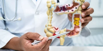 ¿Hay alimentos que limpian el colon?