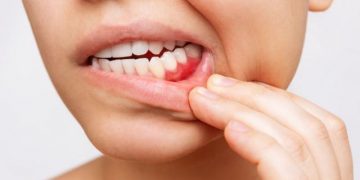 Así afecta lo que comes a la salud de tu boca