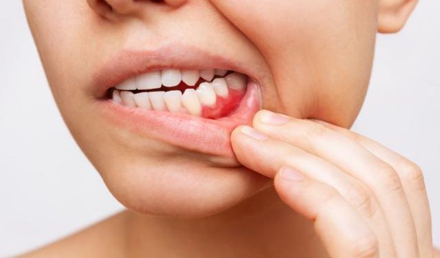 Así afecta lo que comes a la salud de tu boca