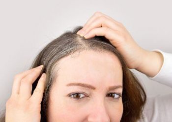 ¿Qué alimentos pueden retrasar la aparición de canas?