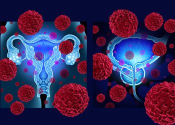 El virus del papiloma humano también produce cáncer en el hombre