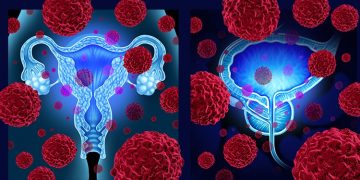 El virus del papiloma humano también produce cáncer en el hombre