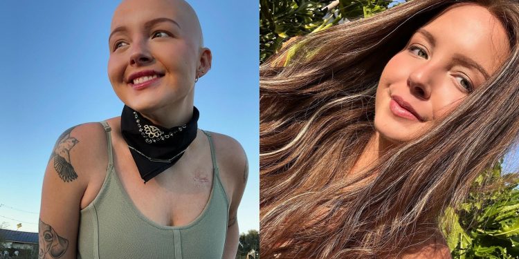 Muere a los 26 años Maddy Baloy, la tiktoker que documentó su lucha contra el cáncer terminal