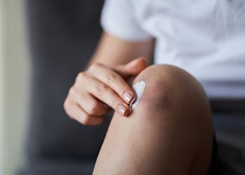 ¿Por qué me salen con frecuencia moratones en la piel sin golpearme?