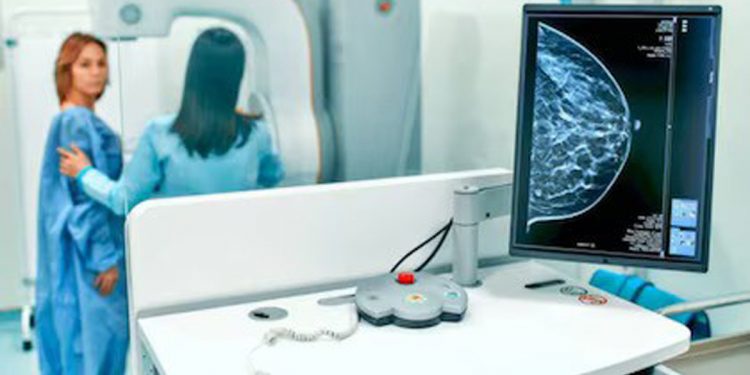 Cómo funciona el test que puede predecir la reaparición del cáncer de mama hasta con 3 años de anticipación