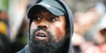 Ex-asistente de Kanye West acusa a su dentista de usar óxido nitroso para «alterar sus facultades mentales».