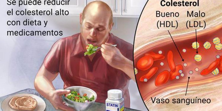 Especialistas insisten en la importancia de reducir el colesterol para prevenir enfermedades cardiovasculares