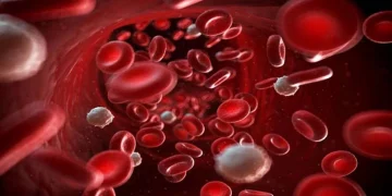 Leucemia, linfoma y mieloma múltiple: señales que alertan sobre un cáncer en la sangre