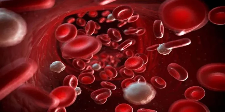 Leucemia, linfoma y mieloma múltiple: señales que alertan sobre un cáncer en la sangre