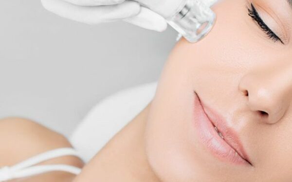 Dermatólogos detallan los efectos secundarios más habituales de los tratamientos faciales para rejuvenecer la piel