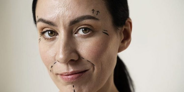 Aquí te presentamos los 5 tratamientos más efectivos para combatir la flacidez facial sin necesidad de recurrir a la cirugía